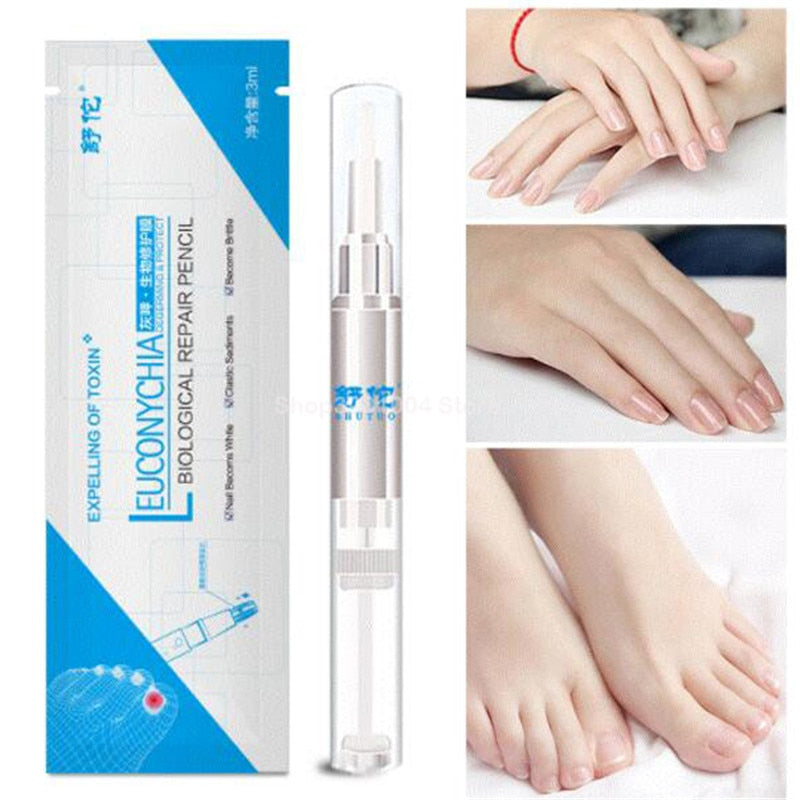 1-3pcs Pro Anti Fungal Nail Treatment Repair Finger Toe Care Nail Fungus  Liquid Pen 4ml | Fruugo AE